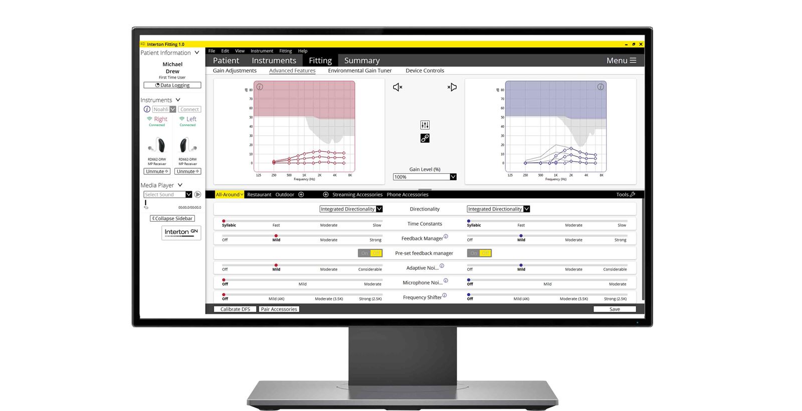 Interton hearing aid fitting: A modernized and improved look and feel make it easier for fitters not familiar with Interton Appraise to be able to adapt to the new Interton fitting tool. 